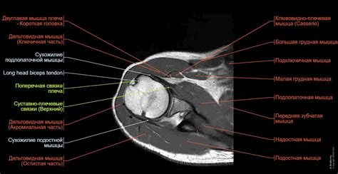 Плечевой сустав МРТ: нормальная анатомия | e-Anatomy