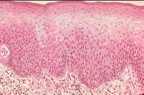 Stratified Squamous Epithelium Diagram