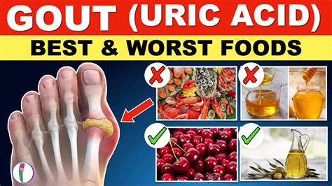 Uric acid Foods to Avoid | Gout Diet Meal Plan | Gout | Uric acid ...