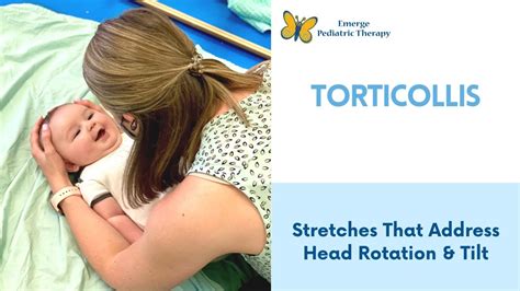 Torticollis: 2 Stretches To Try At Home - YouTube