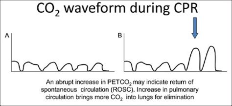 Capnography – Core EM