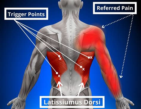 7 Causes of Shoulder Pain and Tingling in the Fingers - Facts & Physio