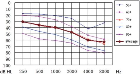 Averaged Pure Tone Audiogram in Different Age Groups | Download ...