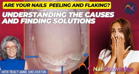 Peeling Nails: Unveiling the Culprits Behind Flaking and Peeling ...