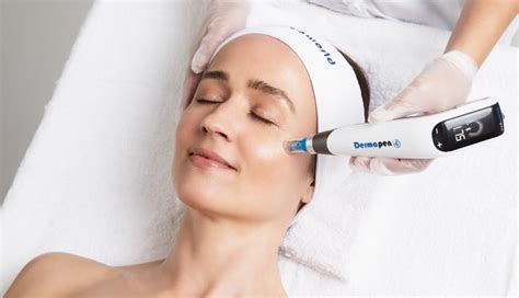 Unlocking the Beauty of dermapen benefits - Nouvel Age Clinics