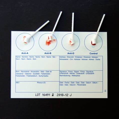 Diy Blood Group Test Kit - Do It Your Self