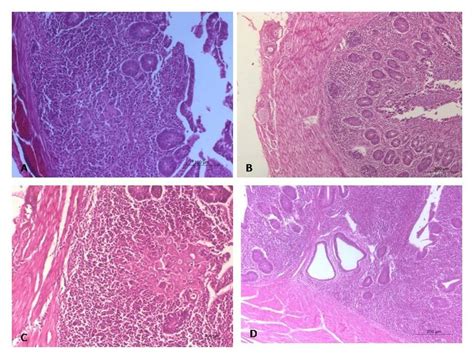 Histopathological picture in the cecum of G4 and G5 birds. A. Cecum in ...