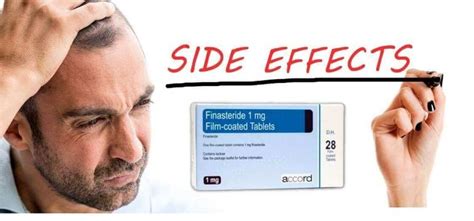 Finasteride Side Effects: A Complete Breakdown | Simple Online Pharmacy