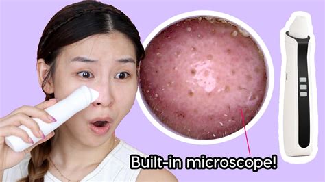 Blackhead Removal Tool Video Youtube - HOWTOERMOV