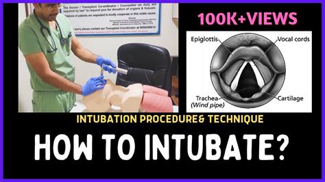 HOW TO INTUBATE? INTUBATION PROCEDURE & TECHNIQUE - YouTube