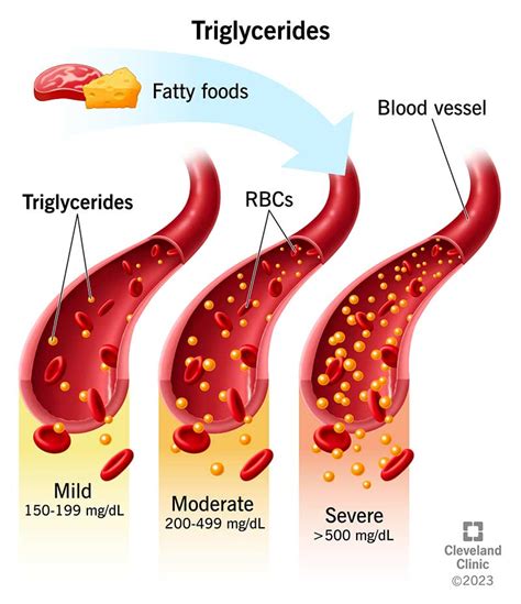 Triglycerides: Levels Normal Range, 40% OFF