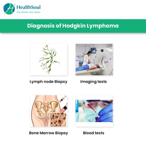 Hodgkin Lymphoma: Symptoms and Treatment – Healthsoul