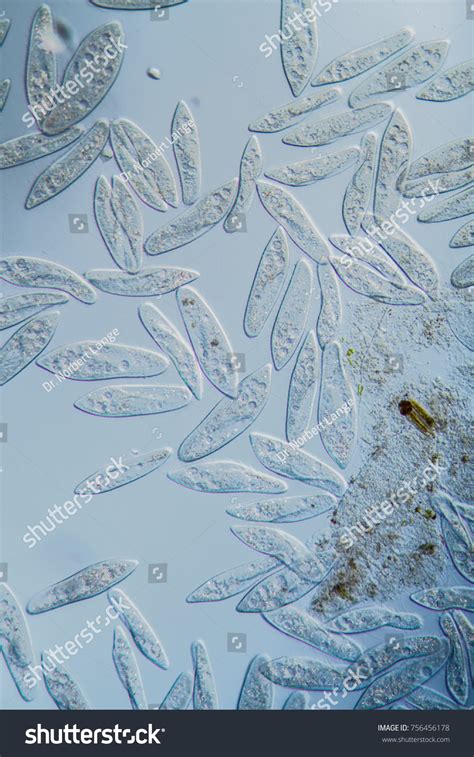 Ciliates Under Microscope Stock Photo 756456178 | Shutterstock