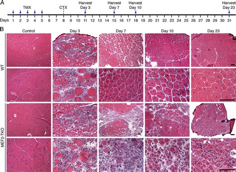 Satellite-cell specific deletion of Mef2a, c and d prevents muscle ...