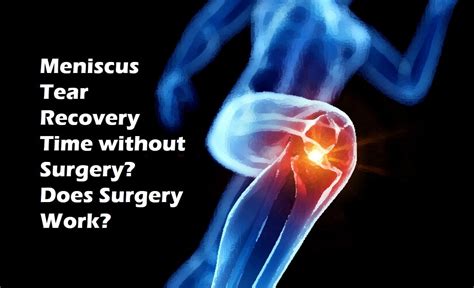 Meniscus Tear Recovery Tme without Surgery?