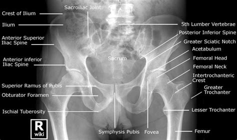 Pelvis Radiographic Anatomy | Medical anatomy, Radiology student ...