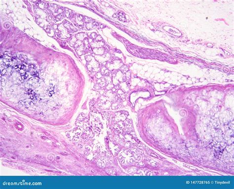 Histology of Epiglottis Human Tissue Stock Image - Image of study, view ...