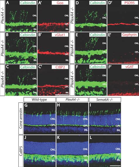 Guidance-Cue Control of Horizontal Cell Morphology, Lamination, and ...