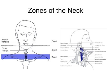 PPT - NECK TRAUMA PowerPoint Presentation, free download - ID:1484373