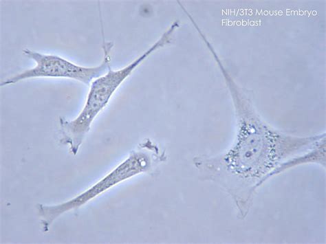 Fibronectin: A Cell Adhesion and Blood Clotting Protein - Owlcation