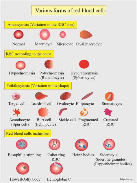 Megaloblastic Anemia Peripheral Smear