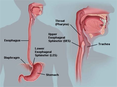 Esophageal dysmotility, esophageal motility disorder, causes, symptoms ...