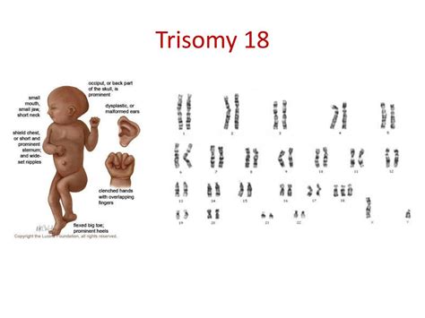 PPT - Genetics in Medicine PowerPoint Presentation, free download - ID ...