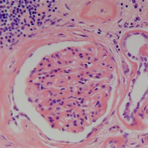 Harris' Hematoxylin - Delta Microscopies