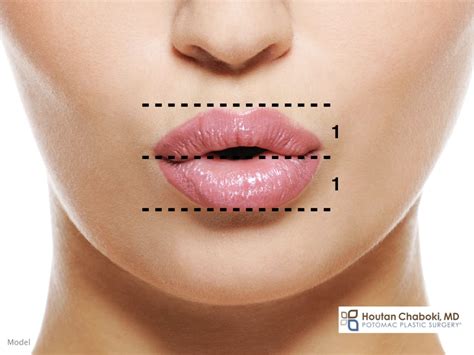 The Ideal Lip Shape in Plastic Surgery