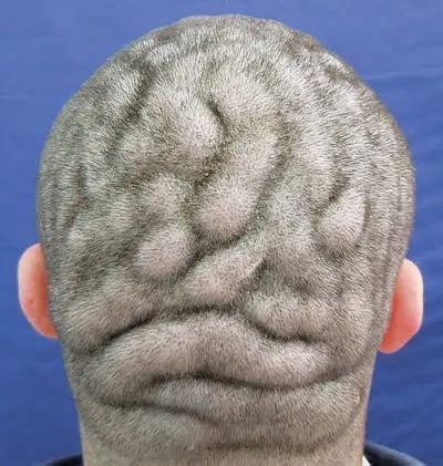 Why Does My Scalp Hurt? List of Causes and Treatment Options