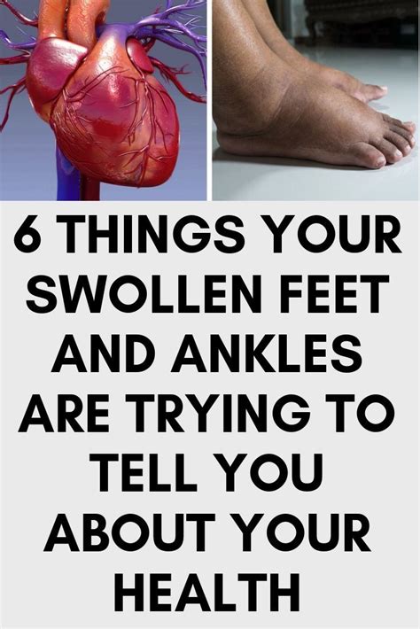 6 Things Your Swollen Feet and Ankles Are Trying to Tell You About Your ...