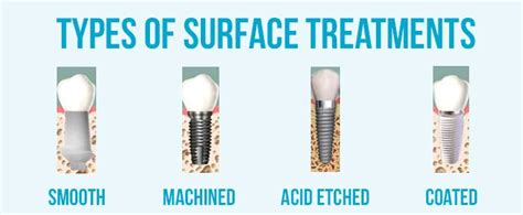 What types of dental implants can be used for your case