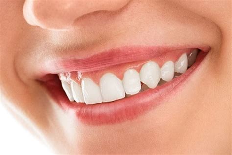 Smile Makeover Treatment - Teeth & Braces Clinic Indore