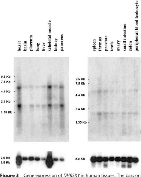 Figure 1 from Differential divergence of three human pseudoautosomal ...