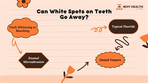 White Spots on Teeth: Treatments and Preventions