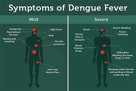 What Is Dengue Fever? | Mosquito Borne Diseases