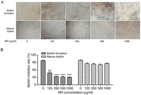 (A) Light microscopy images of biofilm formation and mature biofilm ...