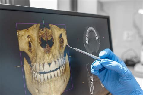 Cone Beam CT - There’s a Code for That - True View Dental Radiology