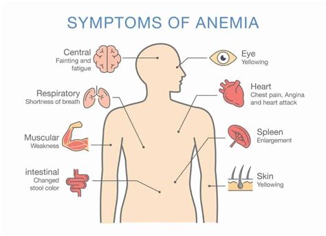 Anemia: Solving an All-Too-Common Mystery - BioDesign Wellness Center