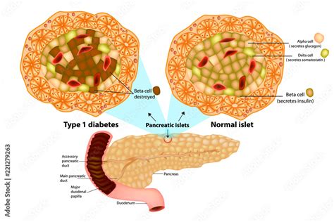 The pancreas has many islets that contain insulin-producing beta cells ...