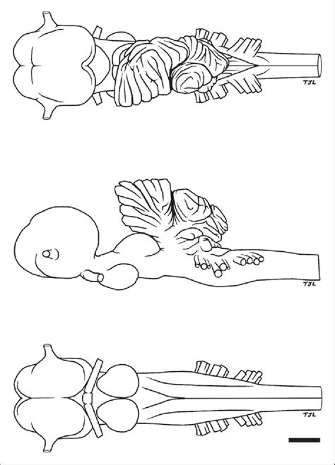 Figure 1 from Brain Size and Brain Organization of the Whale Shark ...