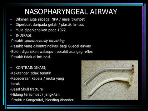 AIRWAY ADJUNCT