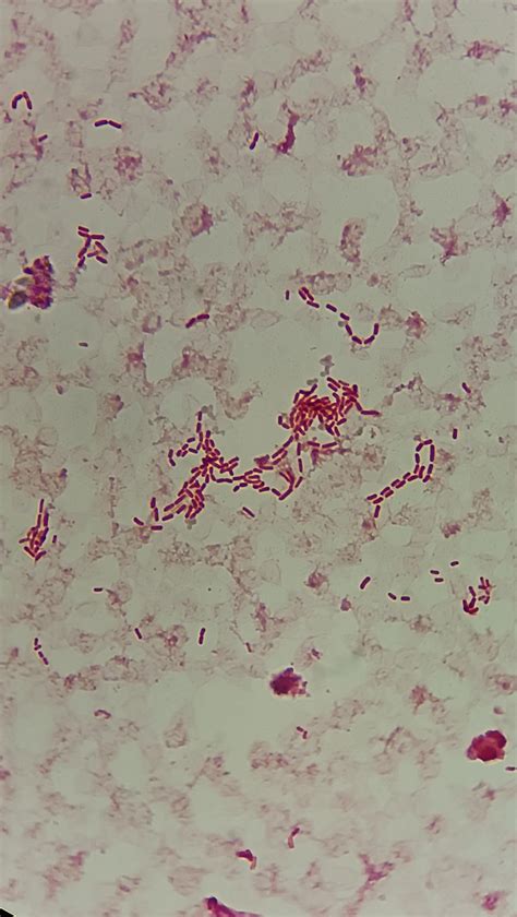 Gram negative bacilli found in a blood culture : r/microbiology