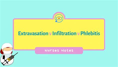 Extravasation vs Infiltration vs Phlebitis: Local Complications of ...