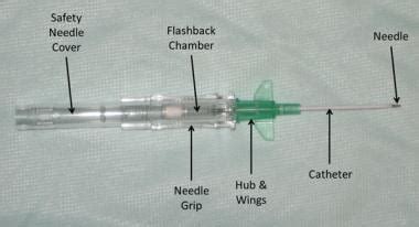 Intravenous Catheter Types