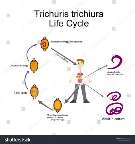 Trichuris Trichiura Life Cyclemedical Parasitologyparasitic Microscope ...