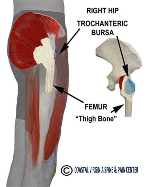 What Is Trochanteric Bursitis Healthy Ask | Images and Photos finder