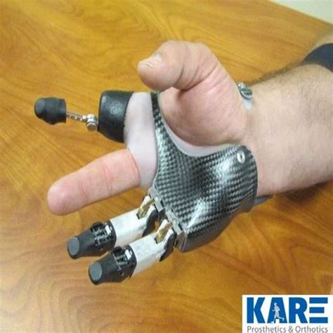 Partial Hand Prosthesis at best price in Bengaluru by KTWO Healthcare ...