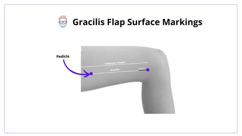 Gracilis Flap - Anatomy, Technique, Indications