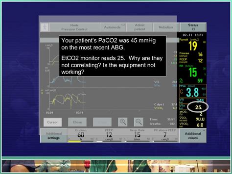 CC - EtCO2 and Waveform Capnography